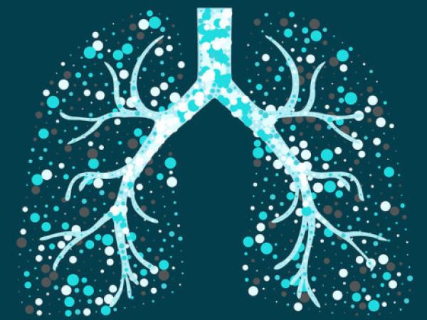 Новина Захворюваність на туберкульоз у Кропивницькому: офіційні дані, лікування Ранкове місто. Кропивницький